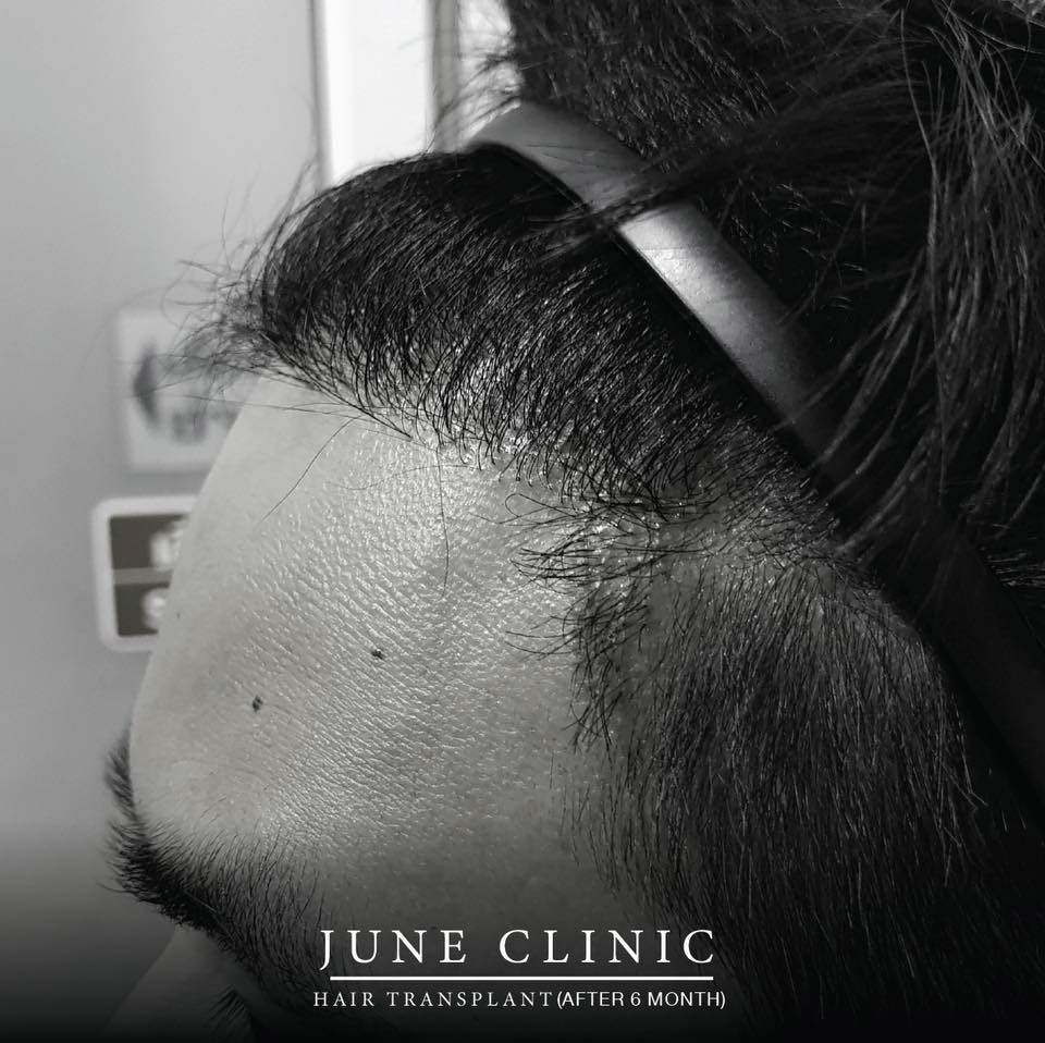 june clinic