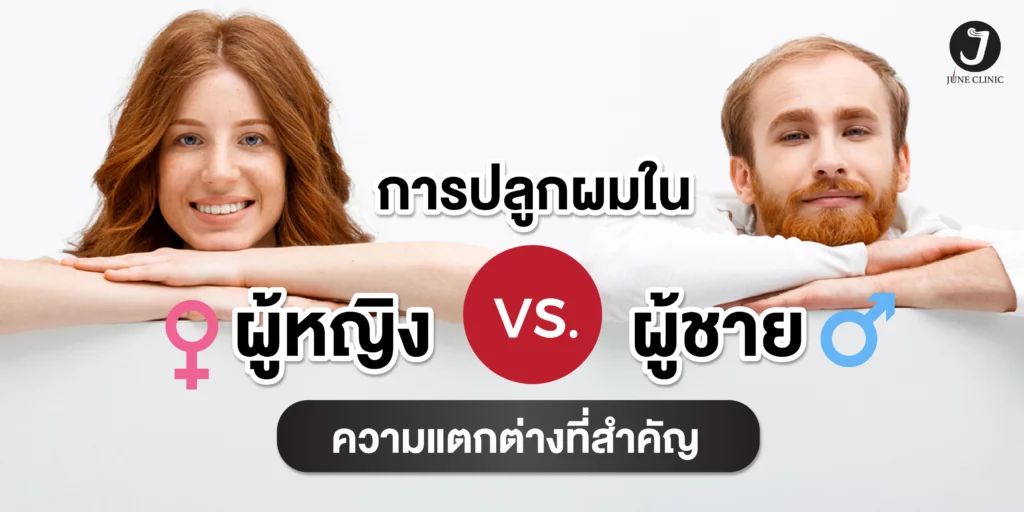 ปลูกผมผู้หญิง VS ผู้ชาย