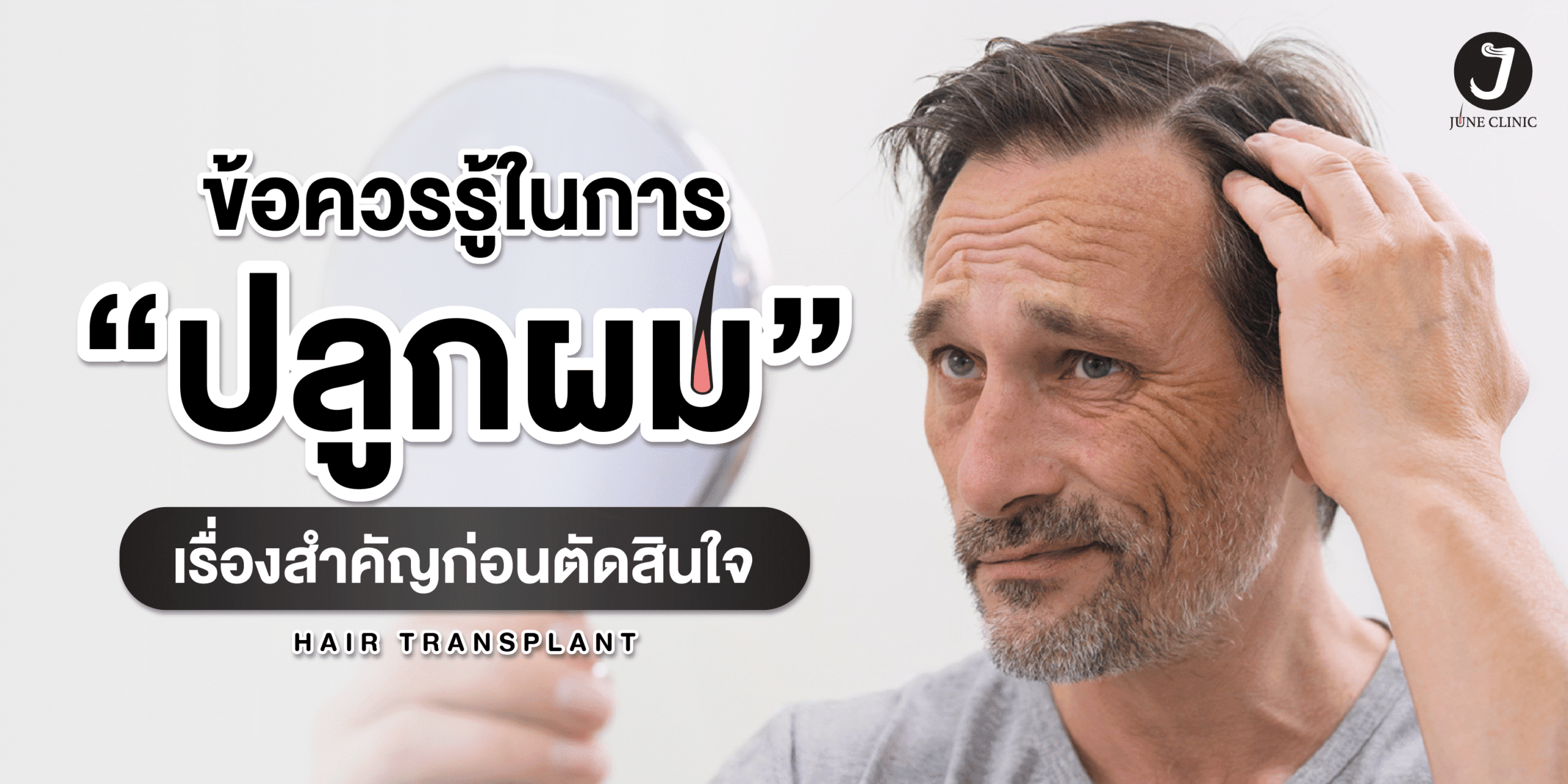 ข้อควรรู้ในการปลูกผม ข้อควรรู้ในการปลูกผม
