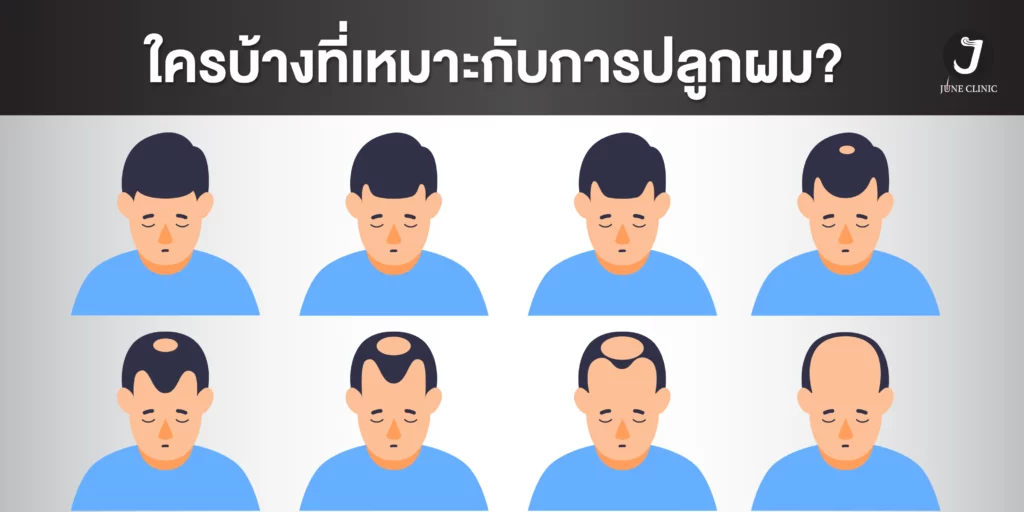 ใครบ้างเหมาะแก่การปลูกผม