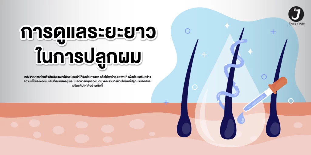 การดูแลระยะยาวในการปลูกผม