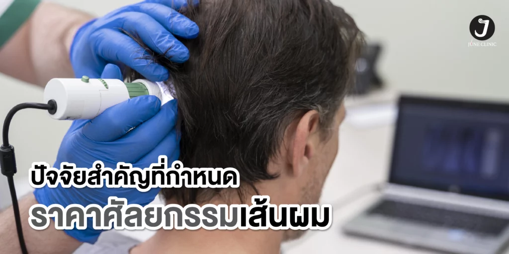 ปัจจัยที่กำหนดราคาศัลยกรรมเส้นผม