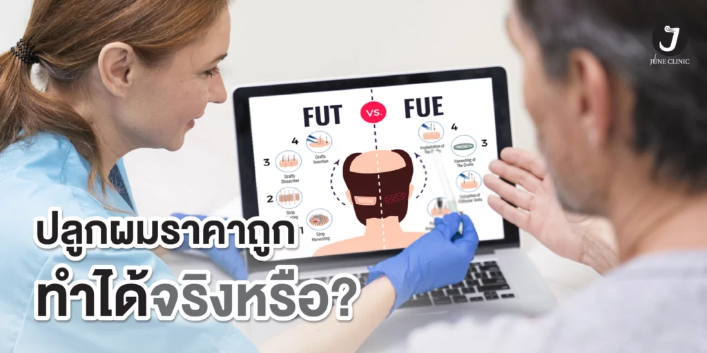 ปลูกผมราคาถูกทำได้จริง?