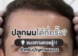 ปลูกผมได้กี่ครั้ง